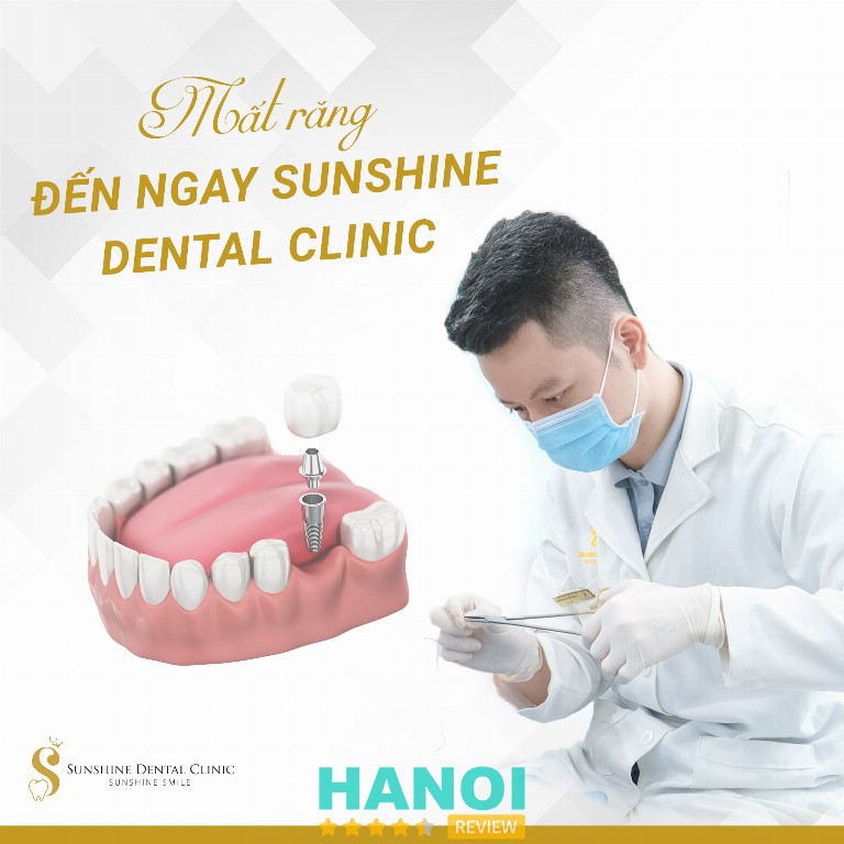 Địa chỉ trồng răng Implant tại Hà Nội 