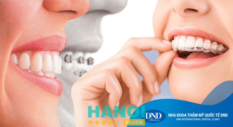 Hệ thống Nha khoa Quốc tế DND