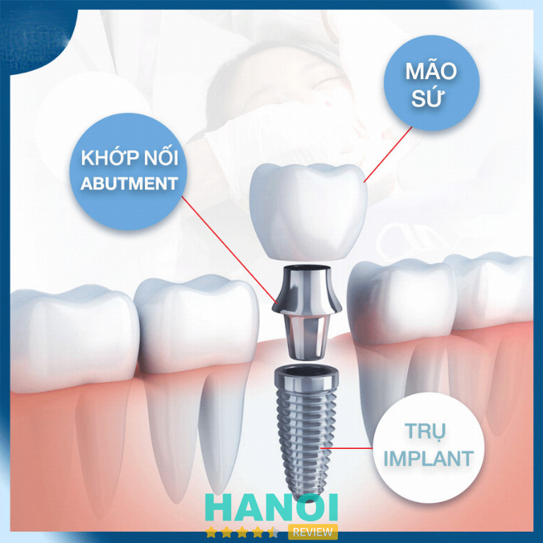 Nha khoa Thẩm mỹ Hàn Quốc Jun Dental quận Cầu Giấy