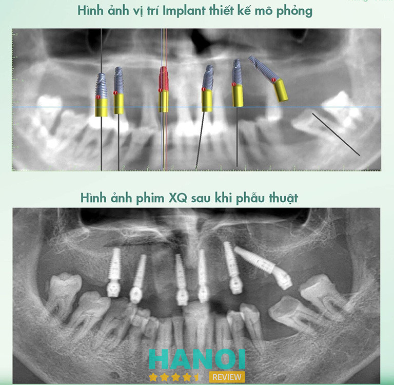 Nha khoa Minh Thu quận Cầu Giấy